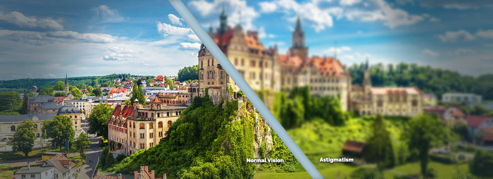 Astigmatism Treatment in Lake Ozark
